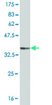 Monoclonal Anti-GRM1 antibody produced in