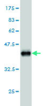 Monoclonal Anti-FLVCR antibody produced in