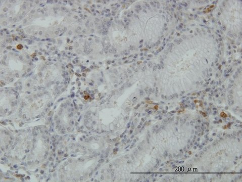Monoclonal Anti-FGL2 antibody produced in