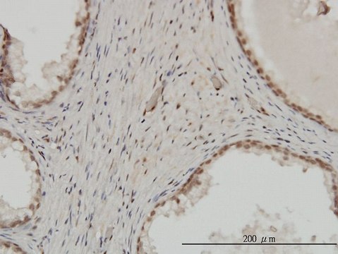 Monoclonal Anti-ZNF202 antibody produced in