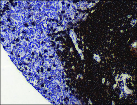 Anti-CD20 antibody, Rabbit monoclonal