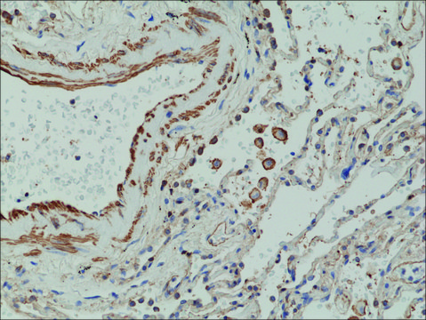 Anti-Matrix metalloproteinase-12 (MMP-12) antibody, Rabbit
