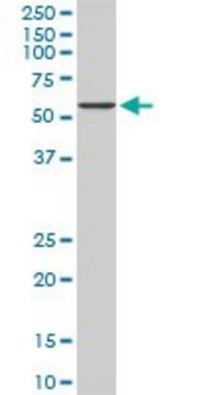 Monoclonal Anti-CACNB2 antibody produced in
