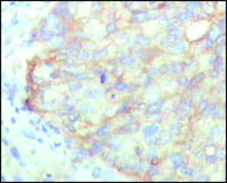 Monoclonal Anti-KARS antibody produced in