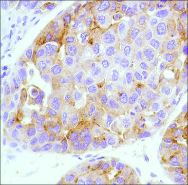 Anti-Alpha-Fetoprotein antibody, Rabbit monoclonal