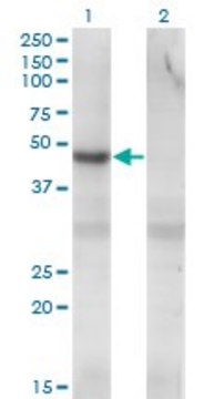 Monoclonal Anti-PIP5K2C antibody produced in
