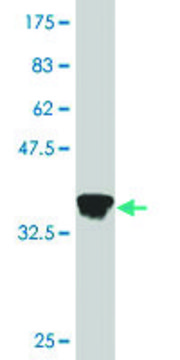 Monoclonal Anti-MGC40579 antibody produced in