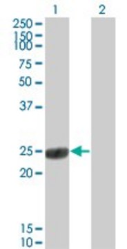 Monoclonal Anti-COMT antibody produced in