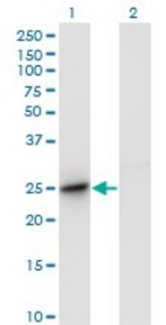 Monoclonal Anti-DC-UbP antibody produced in