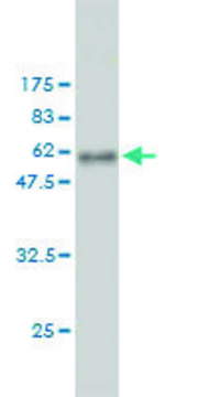 Monoclonal Anti-RDH11 antibody produced in
