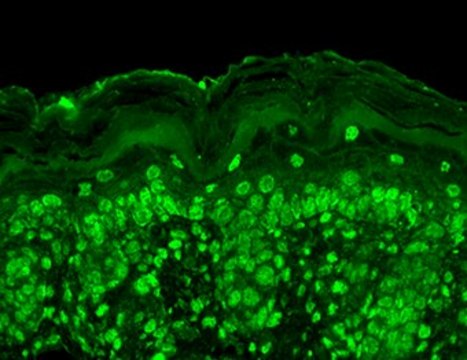Monoclonal Anti-CACNB2 antibody produced in