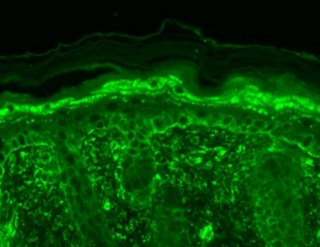 Monoclonal Anti-TRPV3 antibody produced in