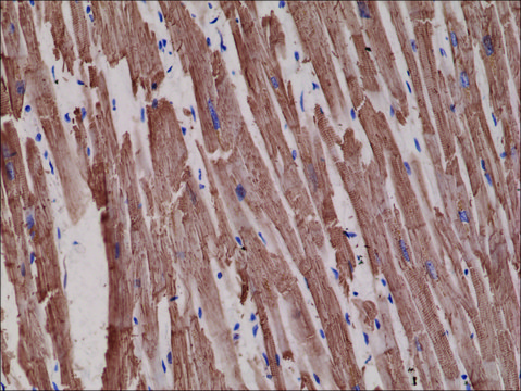 Anti-alpha-Cardiac Actin (ACTC1) antibody, Rabbit