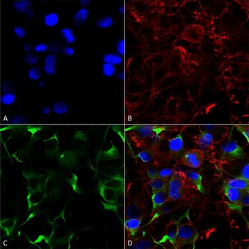 Monoclonal Anti-Gaba-B Receptor 1 -