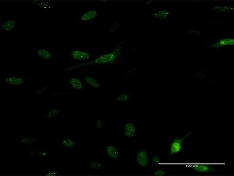 Monoclonal Anti-PDE5A antibody produced in