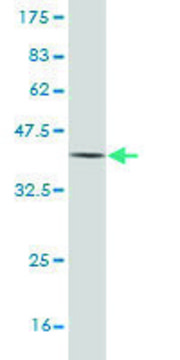 Monoclonal Anti-AADAC antibody produced in