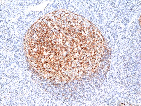 Anti-Clusterin Rabbit Monoclonal Antibody