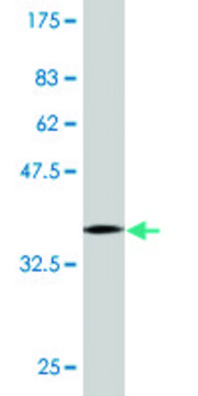 Monoclonal Anti-CGI-121 antibody produced in