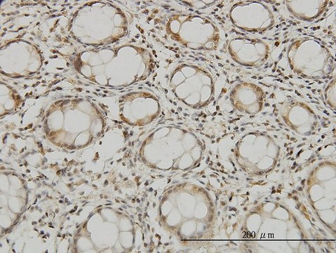 Monoclonal Anti-MTSS1 antibody produced in