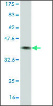 Monoclonal Anti-BBS7 antibody produced in