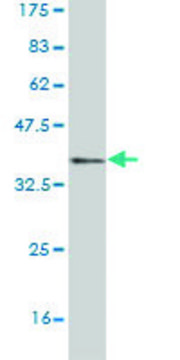 Monoclonal Anti-ACMSD antibody produced in