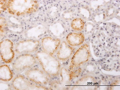 Monoclonal Anti-PHACS antibody produced in
