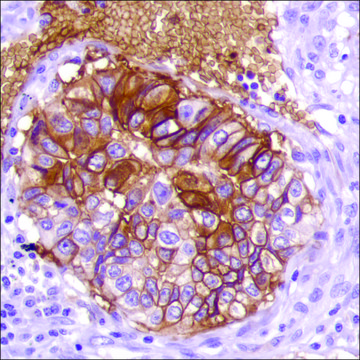 Anti-GLUT-1 antibody, Rabbit monoclonal