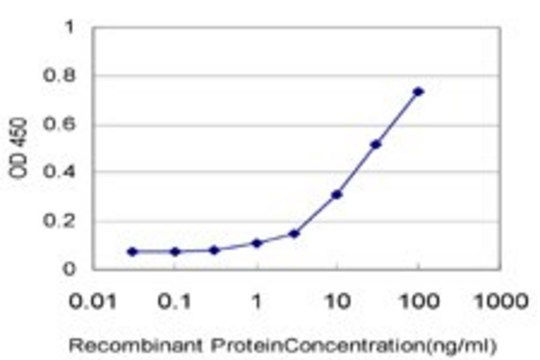 Monoclonal Anti-TTC3 antibody produced in