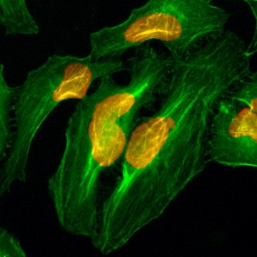 Anti-Histone H2A antibody, Rabbit monoclonal