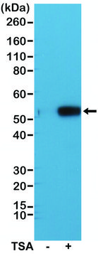 Anti-Acetyl-alpha-Tubulin (Lys40) antibody, Rabbit monoclonal
