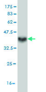 Monoclonal Anti-DKK1 antibody produced in