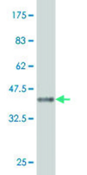 Monoclonal Anti-CA7 antibody produced in