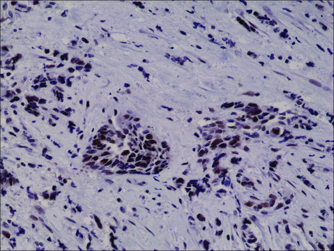 Anti-HIF-1 alpha antibody, Rabbit monoclonal