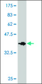Monoclonal Anti-RIPK5 antibody produced in