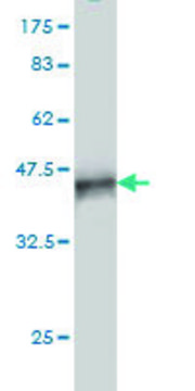 Monoclonal Anti-RIPK4 antibody produced in