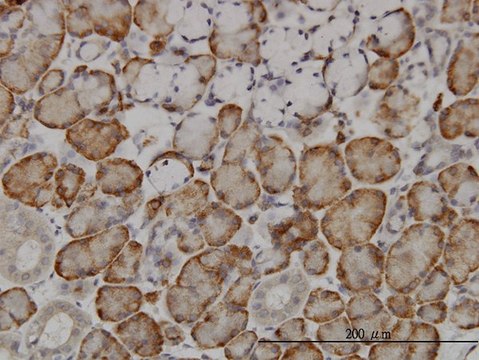 Monoclonal Anti-FBXL18 antibody produced in