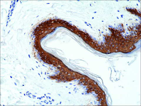Anti-Cytokeratin 10 (CK-10) antibody, Rabbit