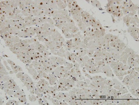 Monoclonal Anti-CCRK antibody produced in