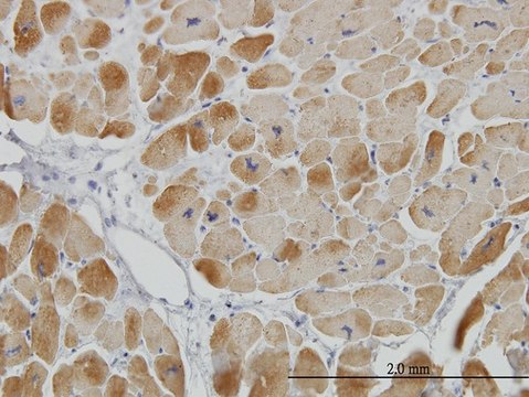 Monoclonal Anti-ACADVL antibody produced in