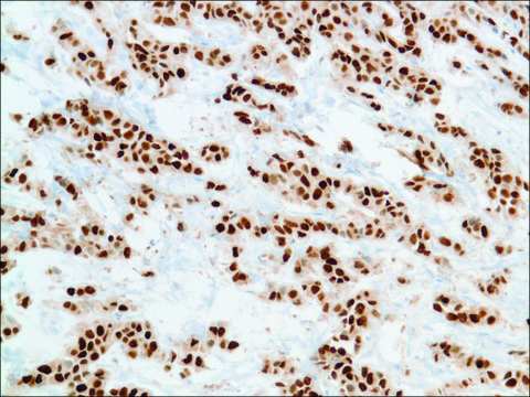 Anti-Progesterone Receptor antibody, Rabbit monoclonal