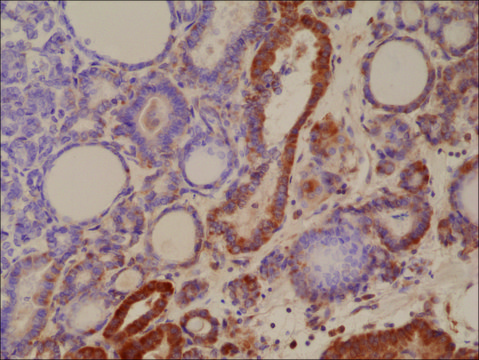 Anti-MUM1/IRF4 antibody, Rabbit monoclonal