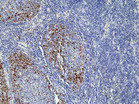 TOP2A (Topoisomerase II?) Rabbit Monoclonal