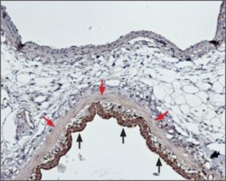Anti-Endothelin Receptor A antibody produced