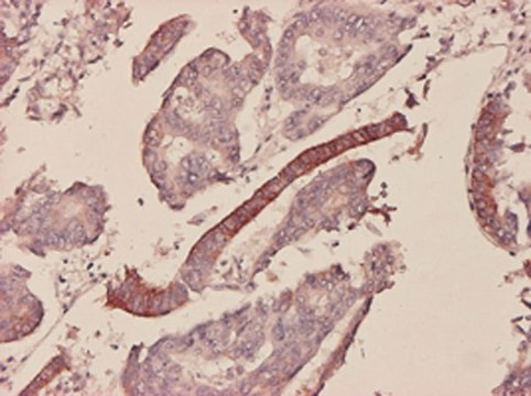 Monoclonal Anti-SAA1 antibody produced in