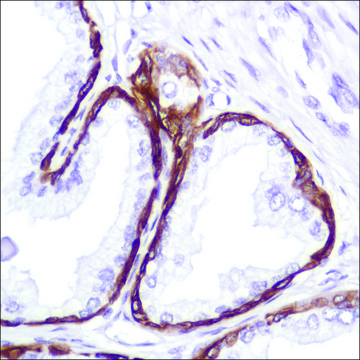 Anti-Keratin 5 antibody, Rabbit monoclonal