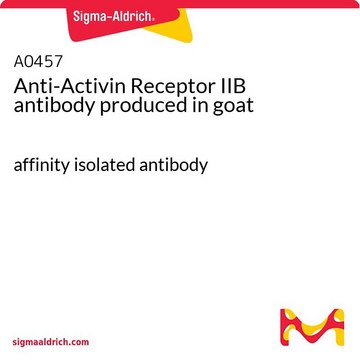 Anti-Activin Receptor IIB antibody produced