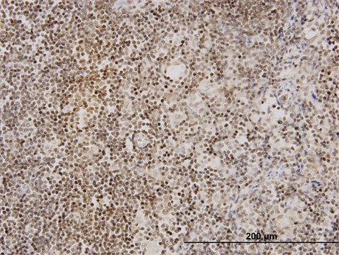 Monoclonal Anti-TNKS antibody produced in