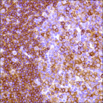 Anti-HLA-DP alpha 1 antibody, Rabbit