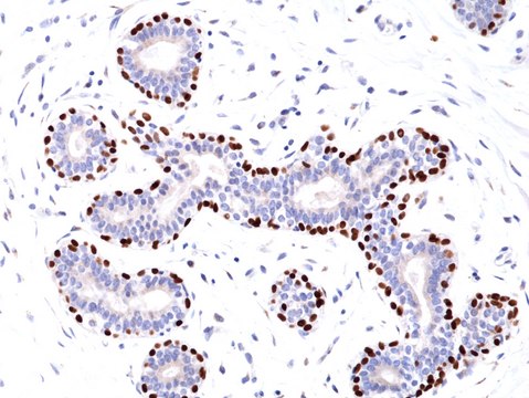 Anti-p63 (Tumor Protein 63) Rabbit