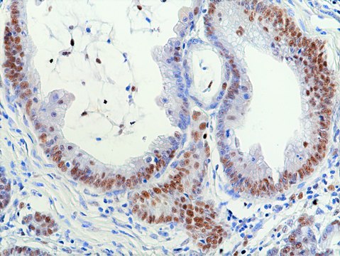 Anti-RNASEH2B Rabbit Monoclonal Antibody